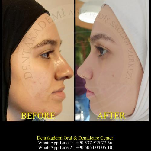 صور قبل وبعد لمرضانا 8